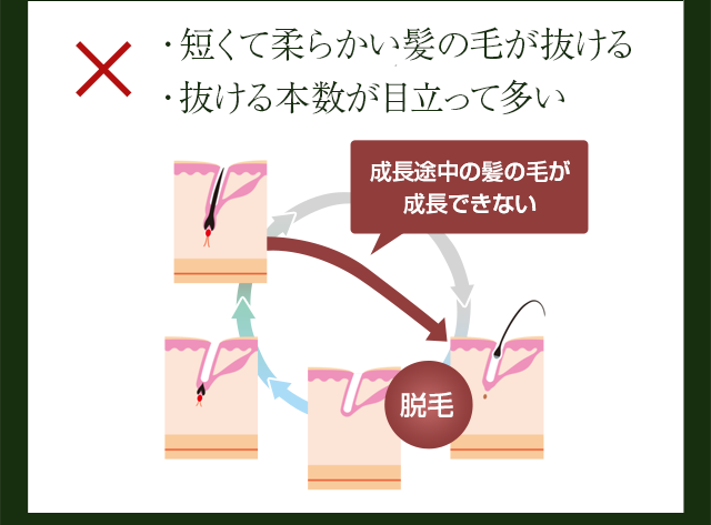 ・短くて柔らかい髪の毛が抜ける・抜ける本数が目立って多い