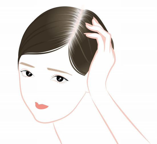 少しでも白髪を抑えたい！ 白髪の原因と今からできる６つの予防法